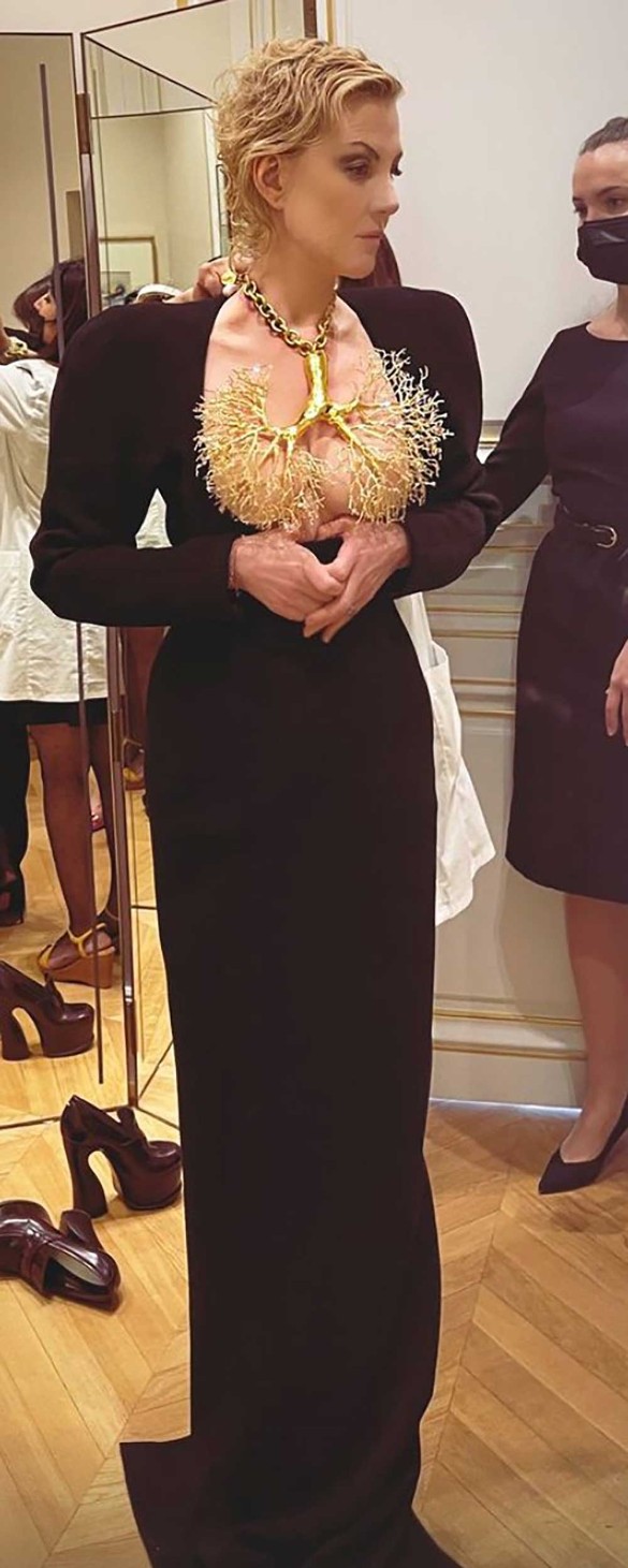 Фото: www.instagram.com/ stories/ renatalitvinovaofficiall/