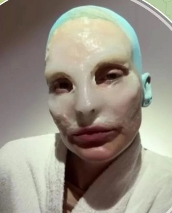 Глюкоза. Фото: соцсети / @glukozamusic