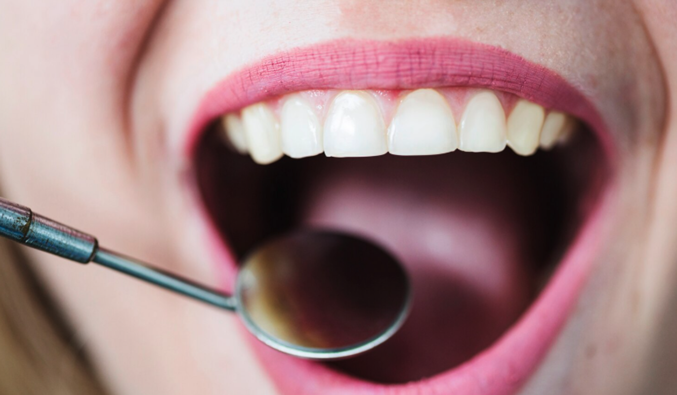 Ученые назвали способ восстановить зубную эмаль естественным путем