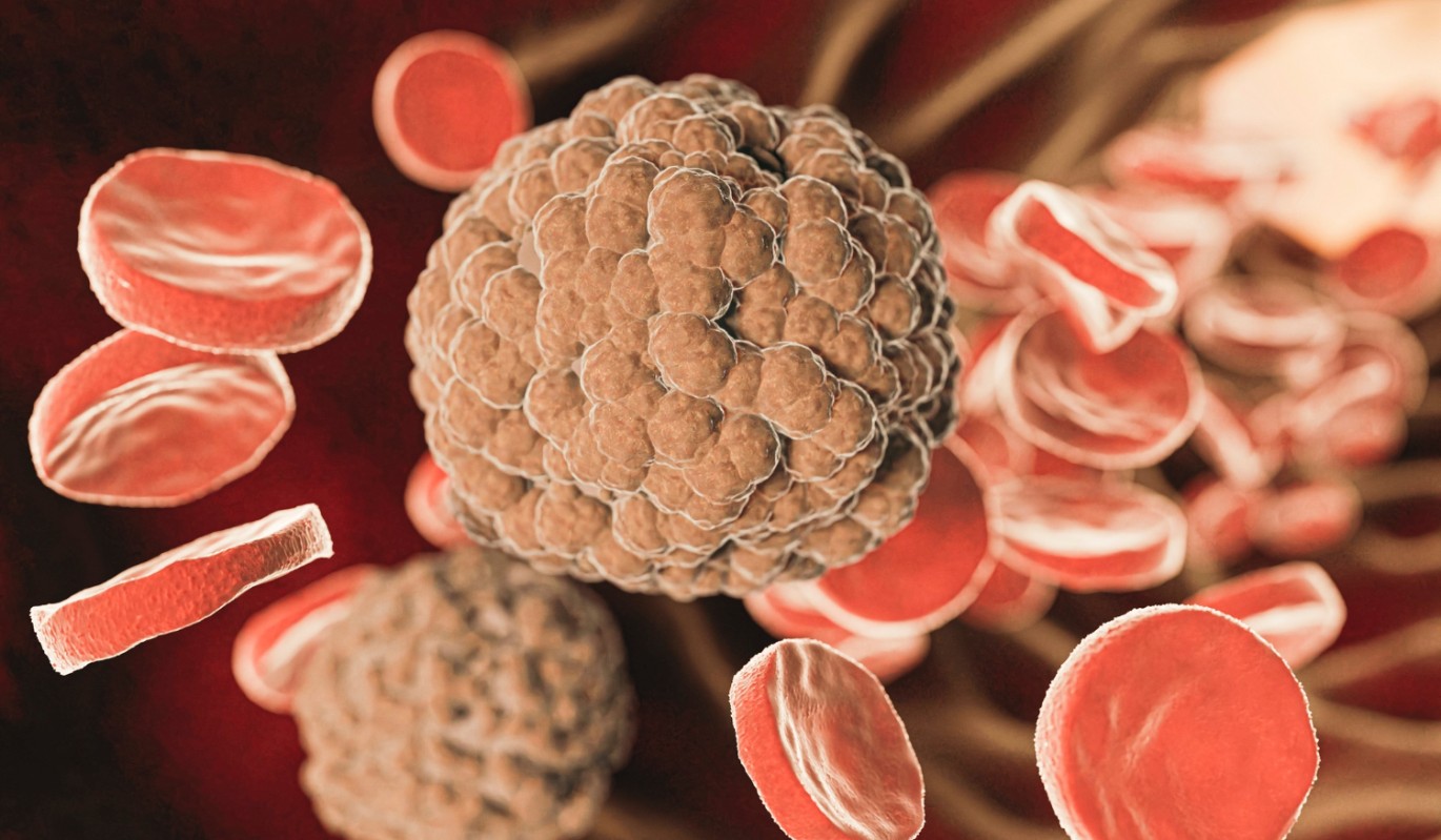 "Чистка сосудов" без таблеток: эксперт назвала 10 продуктов, которые снижают "плохой" холестерин