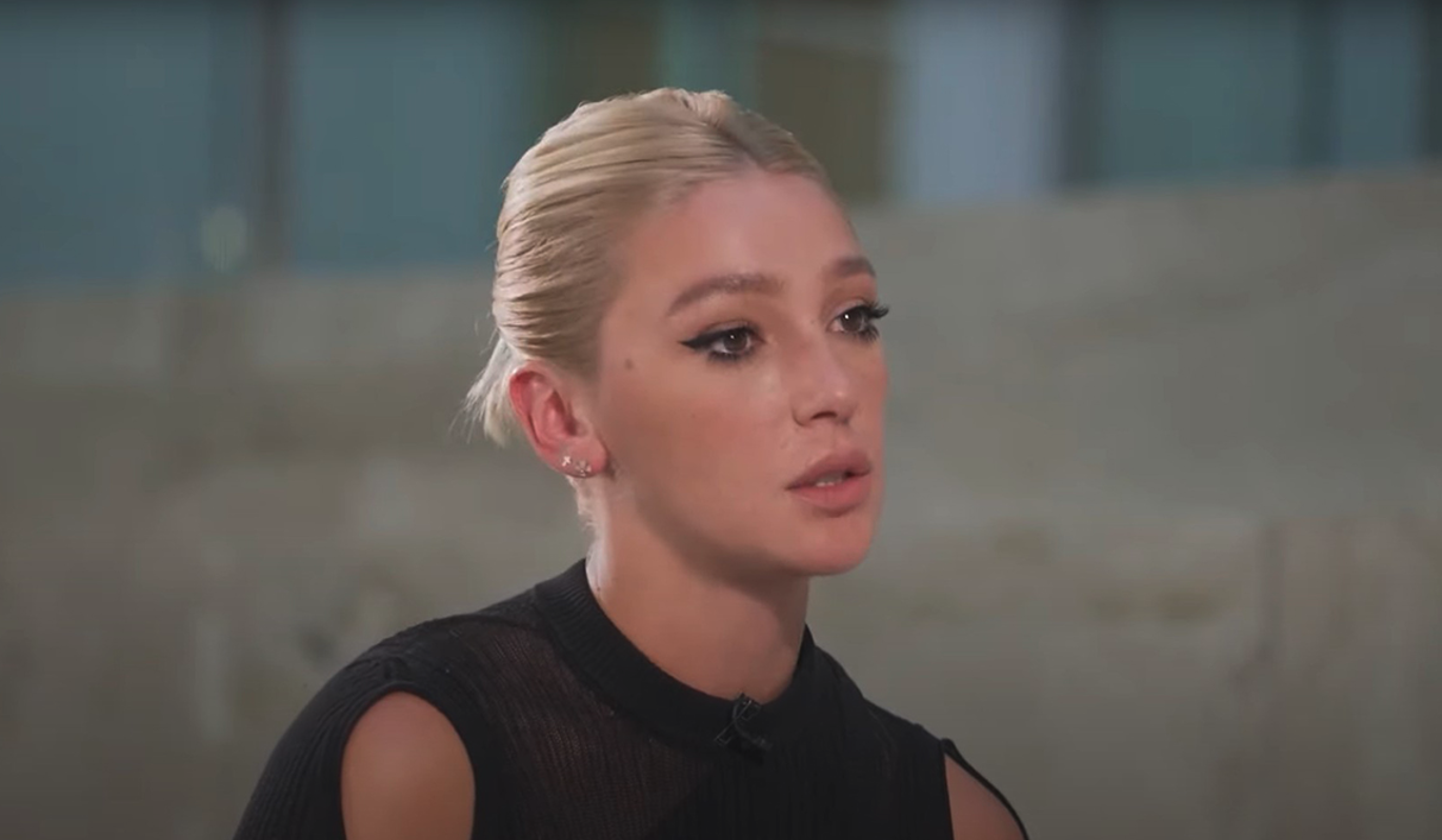 Ивлеева обнаружила на своем теле изъян после слухов о беременности