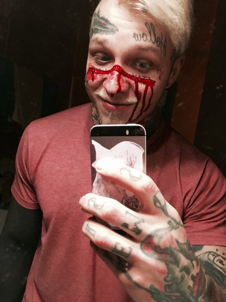 Изменения во внешности Дениса сопряжены с болью и кровью.