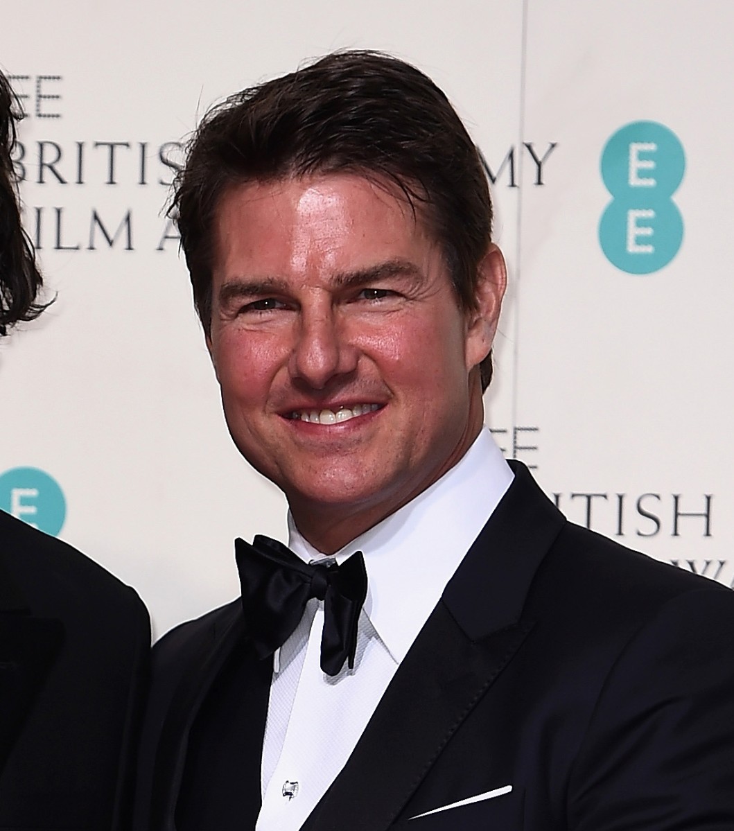 Актер явно перестарался с пластикой - его лицо сильно изменилось.