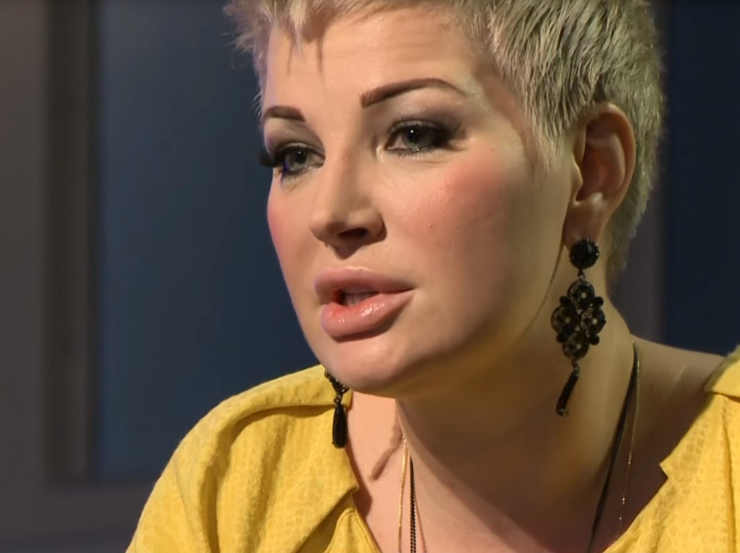 Певица сильно похудела.