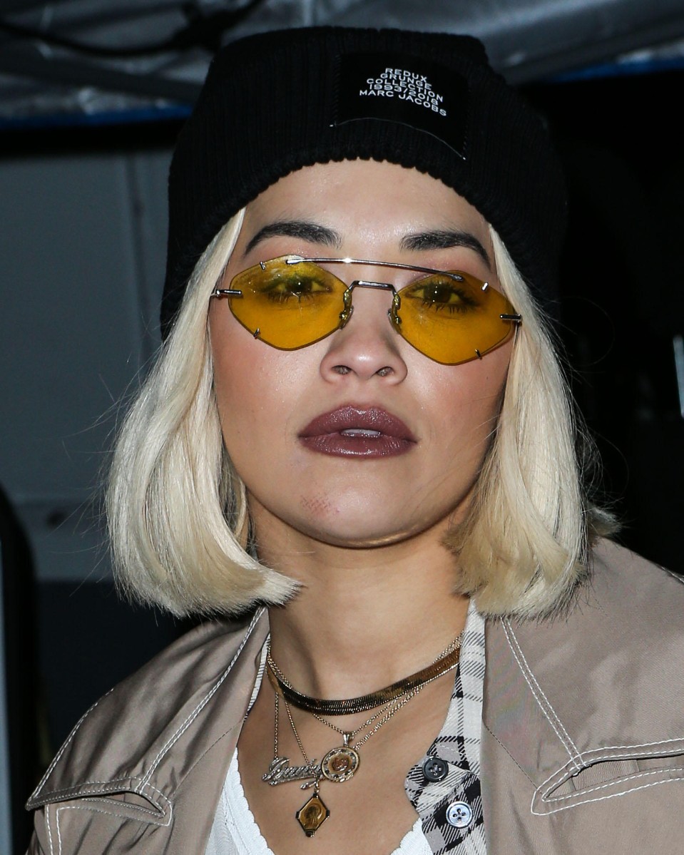 Рита Ора в столь юном возрасте не может похвастаться идеальной кожей.