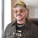 Киркоров объяснил следы увечий на своем теле