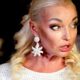 После концерта Волочкова пожаловалась поклонникам на серьезную травму ноги