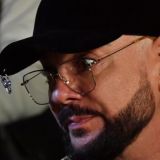 Киркоров поразил россиян экстремальной худобой 