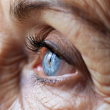 Морщины вокруг глаз: 3 эффективных метода борьбы